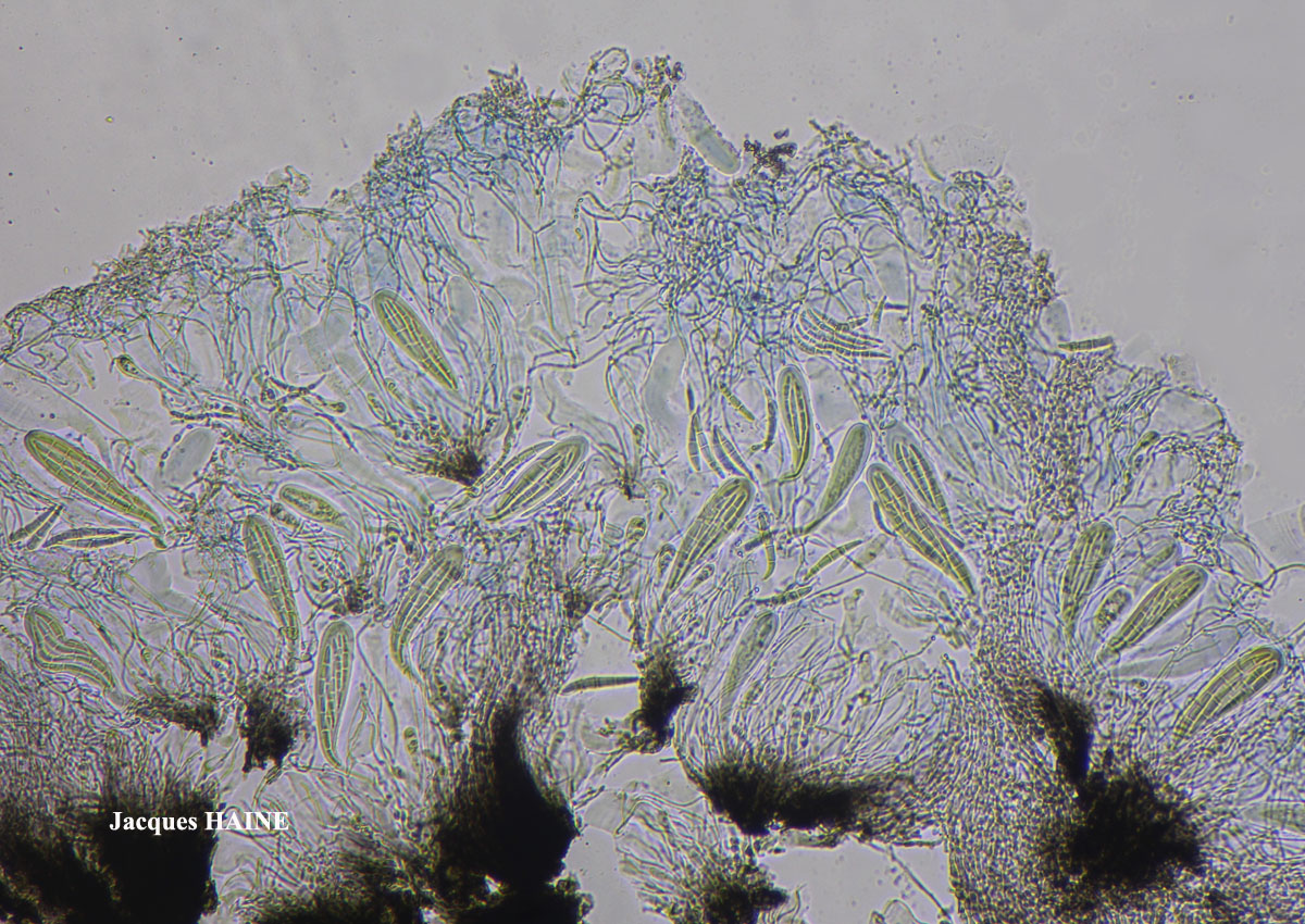 Syncesia myrticola (Fée) Tehler morph apothécié.