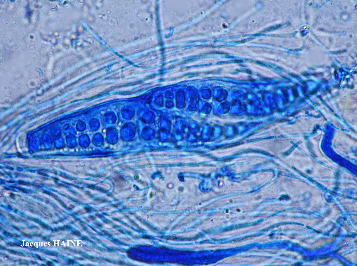 Thelotrema lepadinum forme K+ orange.