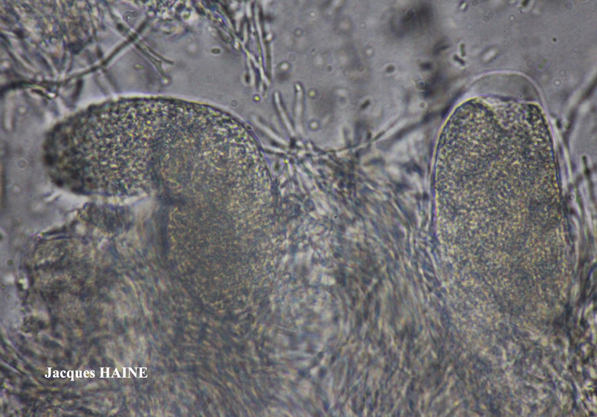 Trimmatothelopsis versipellis (Nyl.) Zsckacke