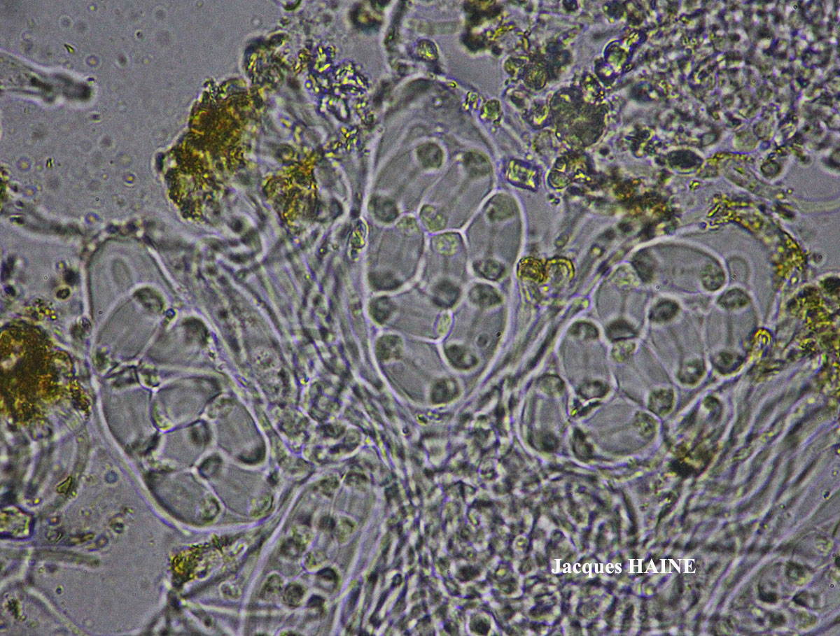 Xanthoria parietina forme saxicole des roches calcaires.